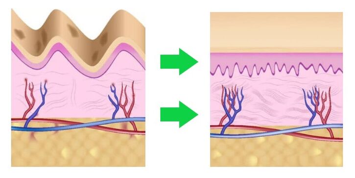 Intenskin aligns d'Haut